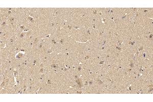 Detection of MMP25 in Human Cerebrum Tissue using Monoclonal Antibody to Matrix Metalloproteinase 25 (MMP25) (MMP25 antibody  (AA 108-313))