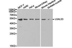 Western Blotting (WB) image for anti-Galectin 3 (LGALS3) antibody (ABIN1873541) (Galectin 3 antibody)