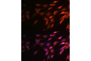 Immunofluorescence analysis of C6 cells using Neurofilament H Rabbit pAb (ABIN6129638, ABIN6144512, ABIN6144513 and ABIN6224502) at dilution of 1:100 (40x lens). (NEFH antibody  (AA 821-1020))