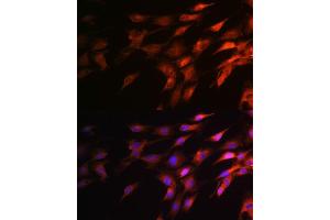 Immunofluorescence analysis of C6 cells using Neurofilament H Rabbit pAb (ABIN6129638, ABIN6144512, ABIN6144513 and ABIN6224502) at dilution of 1:100 (40x lens). (NEFH antibody  (AA 821-1020))