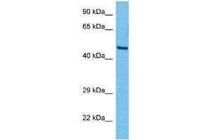 Host:  Mouse  Target Name:  YY1  Sample Tissue:  Mouse Brain  Antibody Dilution:  1ug/ml (YY1 antibody  (Middle Region))