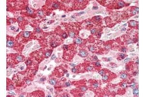 Human Liver (formalin-fixed, paraffin-embedded) stained with CTSDat 10 µg/ml followed by biotinylated goat anti-rabbit IgG secondary antibody, alkaline phosphatase-streptavidin and chromogen. (Cathepsin D antibody)