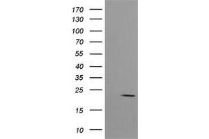 Image no. 2 for anti-HRas proto-oncogene, GTPase (HRAS) antibody (ABIN1498716)