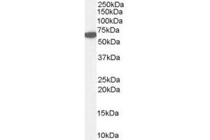 ABIN185651 (1µg/ml) staining of Human Kidney lysate (35µg protein in RIPA buffer). (Catalase antibody  (Internal Region))