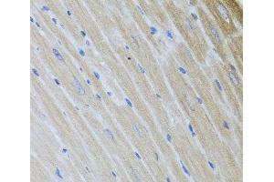 Immunohistochemistry of paraffin-embedded Mouse heart using USP25 Polyclonal Antibody at dilution of 1:100 (40x lens). (USP25 antibody)