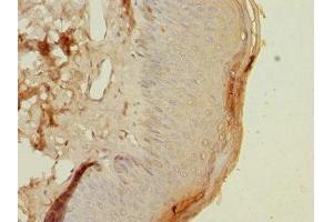 Immunohistochemistry of paraffin-embedded human skin tissue using ABIN7155580 at dilution of 1:100 (HLA-DOA antibody  (AA 26-135))