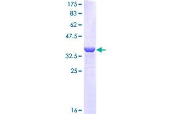 KRT16 Protein (AA 301-398) (GST tag)