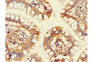 Immunohistochemistry of paraffin-embedded human small intestine tissue using ABIN7143191 at dilution of 1:100 (ACAD9 antibody  (AA 1-270))