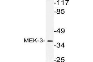 Western blot (WB) analysis of MEK-3 antibody in extracts from Jurkat cells. (MAP2K3 antibody)