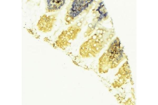 NEK8 antibody  (Internal Region)