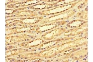 Immunohistochemistry of paraffin-embedded human kidney tissue using ABIN7149476 at dilution of 1:100