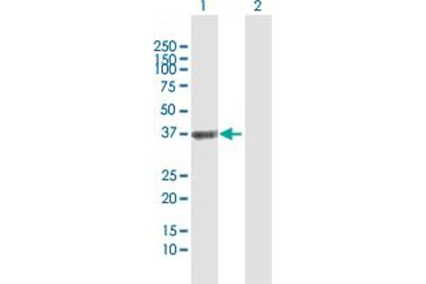 ETV7 antibody  (AA 1-341)
