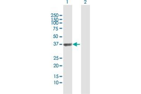 ETV7 Antikörper  (AA 1-341)