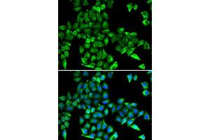 Immunofluorescence analysis of HeLa cells using CST3 antibody. (CST3 antibody)
