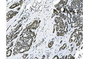 IHC analysis of HOXD11 using anti-HOXD11 antibody (ABIN7603174). (HOXD11 antibody  (N-Term))