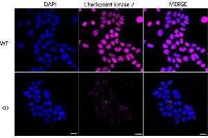 Immunocytochemical staining of Hela cells using Checkpoint kinase 2 antibody (ABIN7798040), 1:1,000), Top panel: wild-type (WT), Bottom panal: Checkpoint kinase 2 shRNA knockdown (KD). (Recombinant CHEK2 antibody)
