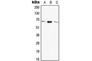 Western blot analysis of Elastin expression in HEK293T (A), SP2/0 (B), H9C2 (C) whole cell lysates. (Elastin antibody  (Center))