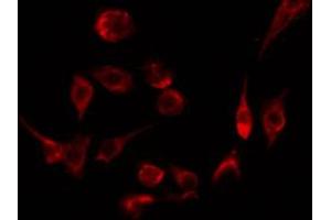 ABIN6274544 staining Hela by IF/ICC. (STAG3 antibody  (C-Term))