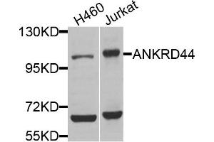 Western blot analysis of extracts of H460 and Jurkat cells, using ANKRD44 antibody.