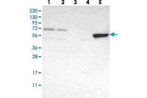 Western blot analysis of Lane 1: RT-4, Lane 2: U-251 MG, Lane 3: Human Plasma, Lane 4: Liver, Lane 5: Tonsil with FAM73A polyclonal antibody  at 1:250-1:500 dilution.