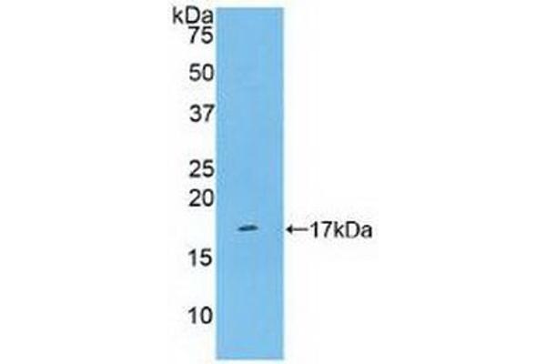 CD161 antibody  (AA 73-188)