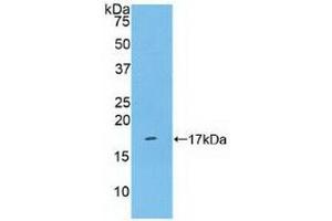 Detection of Recombinant KLRB1, Human using Polyclonal Antibody to Cluster Of Differentiation 161 (CD161) (CD161 antibody  (AA 73-188))