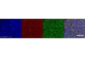 Immunohistochemistry (IHC) image for anti-Dopa Decarboxylase (Aromatic L-Amino Acid Decarboxylase) (DDC) antibody (ABIN7456246) (DDC antibody)