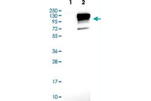 Western blot analysis of Lane 1: Negative control (vector only transfected HEK293T lysate) Lane 2: Over-expression lysate (Co-expressed with a C-terminal myc-DDK tag (~3. (Neuroligin 3 antibody)