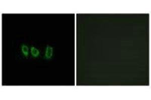 Immunofluorescence analysis of A549 cells, using CSTL1 antibody.