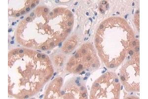 DAB staining on IHC-P; Samples: Human Kidney Tissue (DGKE antibody  (AA 243-502))