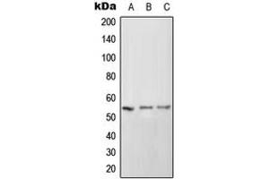 Western blot analysis of CD102 expression in HeLa (A), SP2/0 (B), PC12 (C) whole cell lysates.