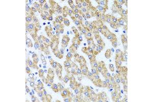 Immunohistochemistry of paraffin-embedded human liver injury using INADL antibody at dilution of 1:100 (x40 lens). (PATJ antibody)