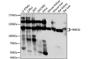 Western blot analysis of extracts of various cell lines, using RNF20 antibody (ABIN7270072) at 1:1000 dilution. (RNF20 antibody  (AA 1-260))