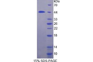 Image no. 1 for Interleukin 12 Receptor beta 1 (IL12RB1) (AA 197-348) protein (His tag,GST tag) (ABIN4988791)