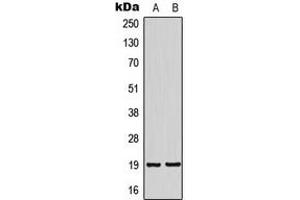 Western blot analysis of NSG2 expression in SHSY5Y (A), HeLa (B) whole cell lysates. (NSG2 antibody  (Center))