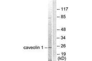 Western blot analysis of extracts from HuvEc cells, using Caveolin-1 Antibody. (Caveolin-1 antibody  (AA 129-178))