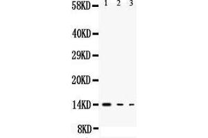 Anti-IL3 antibody, Western blotting All lanes: Anti IL3  at 0. (IL-3 antibody  (Middle Region))