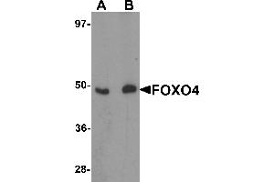 Western Blotting (WB) image for anti-Forkhead Box O4 (FOXO4) (N-Term) antibody (ABIN1031385) (FOXO4 antibody  (N-Term))