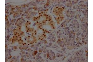 IHC image of ABIN7127582 diluted at 1:100 and staining in paraffin-embedded human pancreatic tissue performed on a Leica BondTM system. (Recombinant ISL1 antibody)