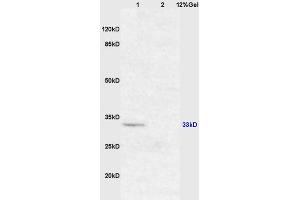Lane 1: mouse brain lysates Lane 2: mouse intestine lysates probed with Anti XAF1/FBXO39 Polyclonal Antibody, Unconjugated (ABIN674754) at 1:200 in 4 °C.