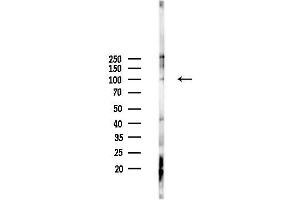 anti-Retinoblastoma Binding Protein 8 (RBBP8) (pThr847) antibody