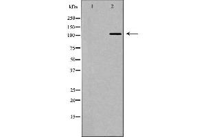 Western blot analysis of extracts of Jurkat, using IFIH1 antibody. (IFIH1 antibody  (C-Term))