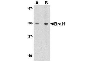 Western blot analysis of BRAL1 in human brain tissue lysate with BRAL1 antibody at (A) 1 and (B) 2 μg/ml.