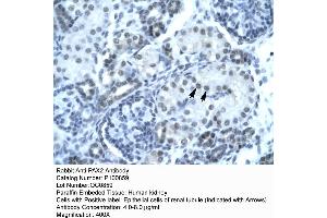 Rabbit Anti-PAX2 Antibody  p100859 Paraffin Embedded Tissue: Human Kidney Cellular Data: Epithelial cells of renal tubule Antibody Concentration: 4. (PAX2A antibody  (Middle Region))