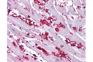 KCNA10 antibody was used for immunohistochemistry at a concentration of 4-8 ug/ml. (KCNA10 antibody  (N-Term))