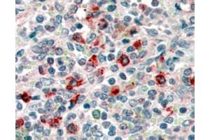 Image no. 1 for anti-CD14 (CD14) (Internal Region) antibody (ABIN374645) (CD14 antibody  (Internal Region))