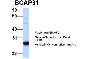 Host:  Rabbit  Target Name:  BCAP31  Sample Type:  Human Fetal Heart  Antibody Dilution:  1. (BCAP31 antibody  (Middle Region))
