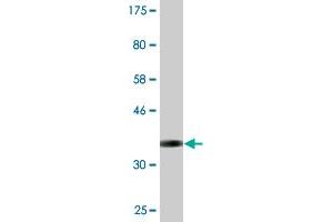 Western Blot detection against Immunogen (37. (Syndetin/VPS50 antibody  (AA 862-964))