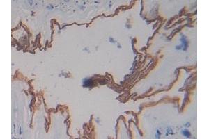 Immunohistochemistry (IHC) image for anti-Pregnancy Zone Protein (PZP) (AA 1224-1495) antibody (ABIN7438847)