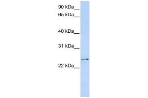 WB Suggested Anti-RCAN3 Antibody Titration:  0. (RCAN3 antibody  (Middle Region))
